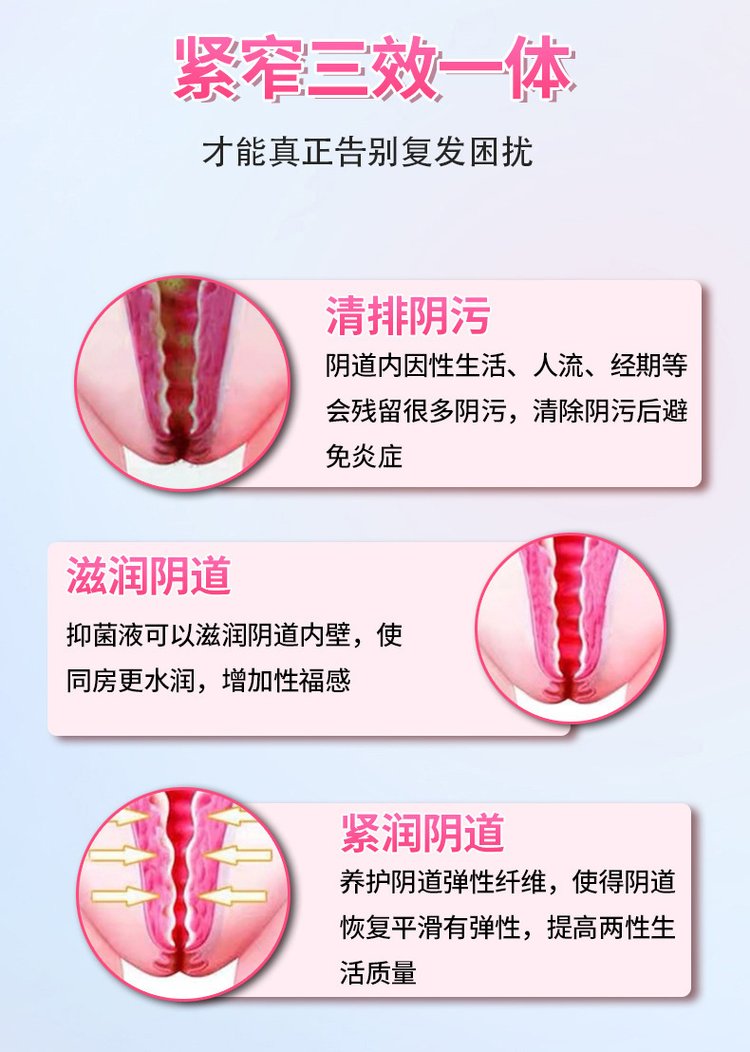 冰凝舒茵緊潤(rùn)婦科膠囊讓你告別復(fù)發(fā)困擾